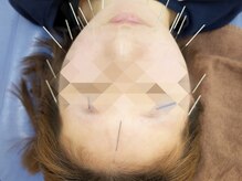 みてら鍼灸整骨院/