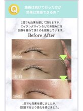 プラスベル(plus Belle)/ラミネーションピール