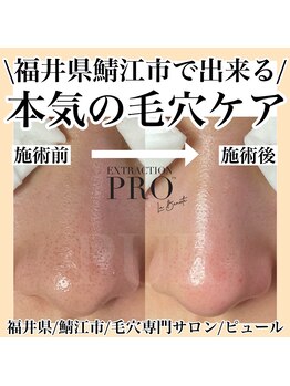 ピュール 鯖江店(PUR)/毛穴サロン/毛穴ケア/毛穴洗浄