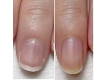 ネイルサロン アイリー(Nail salon Irie)の雰囲気（【ジェルを塗らずに自爪育成】3ヶ月で縦長美爪へ☆）