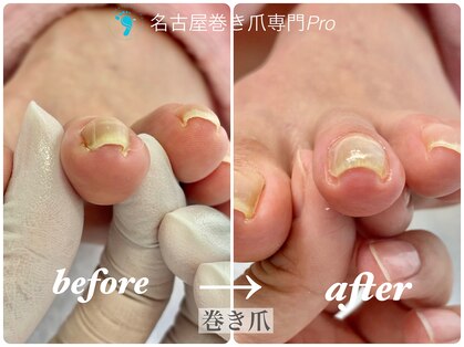 名古屋巻き爪専門Proの写真