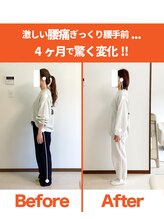 整体院ひなた 宮崎院/腰痛に怯えていた日々から解放!!
