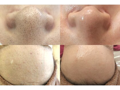 アナシアビューティーサロン(Anacia)の写真
