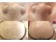 アナシアビューティーサロン(Anacia)の写真