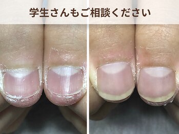 ブルームーンネイルズ(BLOOMOON.nails)/