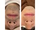 スリーズララ(Cerise LaLa)の写真
