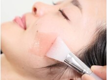 鍼灸院リンダ(鍼灸院LINDA)/オススメの炭酸ジェルパック