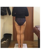 プリンセス バイ セイフティプリンセス 長野店(PRINCESS)/最初は凸凹セル脂肪を分解