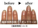 深爪スタンダードコース¥11,000