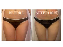 モテスリム/スペシャルダイエットメニュー