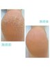 【本格的つるつる角質ケア】（足裏全体）45分～90分　6000円～