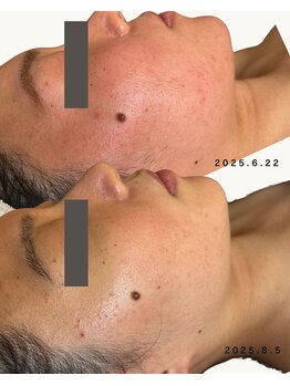 オーク(o.a.k)/お客様ビフォーアフター