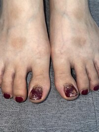 ボルドーフットネイル
