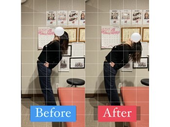 ナオル整体 宮崎院(NAORU整体)/20代女性施術事例【腰痛改善】