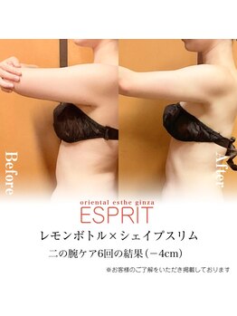 エスプリ 新宿店/レモンボトル×シェイプスリム