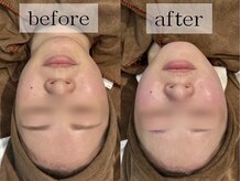 グランビューティ(Glanz Beauty)の雰囲気（光フォトで、フェイスラインすっきり&トーンUP！）