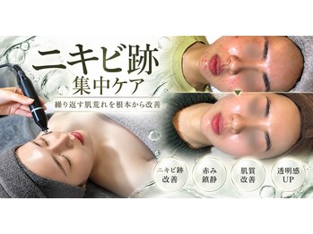 フェイシャル専門店STERN -先進美容理論&厳選成分-の写真/【繰り返す肌荒れに悩まないす肌へ】肌荒れ集中コース