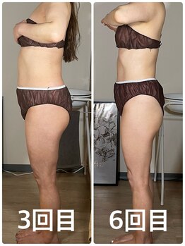 サロン ド サッコ(salon de sacco)/【6回終了後】ビフォーアフター