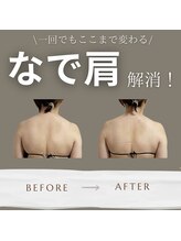 オルオル(.olu olu)/なで肩解消！