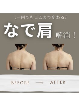 オルオル(.olu olu)/なで肩解消!