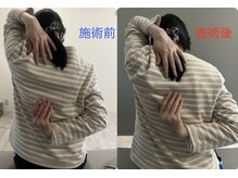 ルミエール(Rumiere)/結滞動作の変化