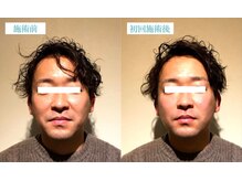 マリーボーテ 名古屋店/【小顔１回】男性にも大人気です