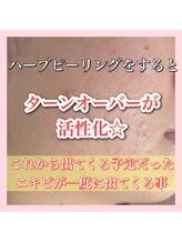 アルムダアクア 天王寺店(Aleumda AQUA)/ハーブピーリング/大阪/天王寺