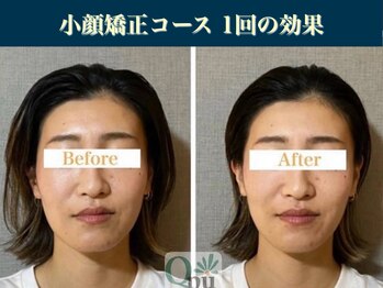キュープ 表参道店(Qpu)/継続が「小顔」と「美」をつくる