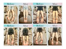 天空の手もみの雰囲気（美脚矯正とフットリンパマッサージでむくまない美脚へ(O脚矯正)）