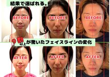 ジェイペック鍼灸整骨院