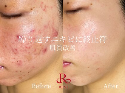 ラティーナ(Lattina)の写真