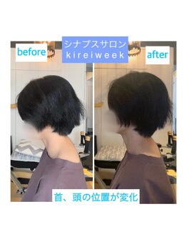 きれいウィーク 恵比寿/頚椎施術before、after