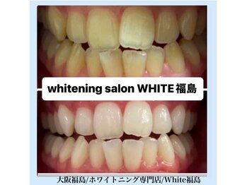 ホワイトニングサロン ホワイト(WHITE)/セルフホワイトニング/大阪/福島