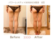 リトリト(Retreat)の雰囲気（続ける事で代謝も変わり戻りにくく綺麗なボディに♪）