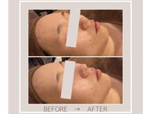 ミルトゥ(myrte)/Before→After