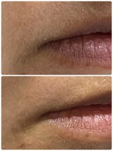 ギャラクシービューティー(galaxy beauty)/WAXでツルツル肌！