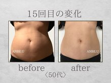 アンビーユー(ANBE.U)/腸もみビフォーアフター