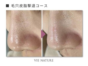 ヴィナチュール(vie nature)/ ■毛穴ケア