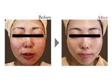 ビューティークリニックコダマ 都城店の雰囲気(全国エステダーマコンテストでグランプリ受賞しました!)