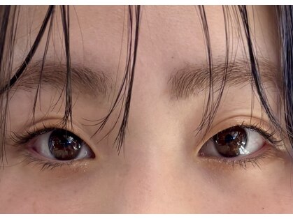 シュール(Sure)の写真