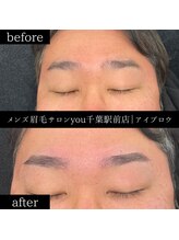 ユー 千葉駅前店(you)/ビフォ－アフター写真
