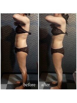 ラクラク(rakuraku)/痩身【全身】90分(1回目)