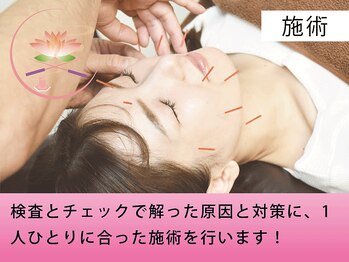 健美庵/鍼灸施術を行います