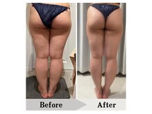 エミット(emit.)/足の脂肪もスッキリ