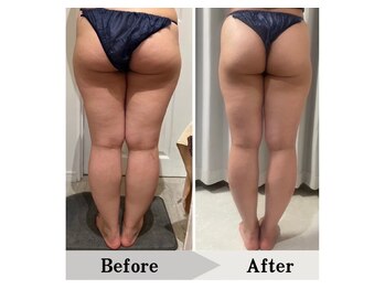 エミット(emit.)/足の脂肪もスッキリ