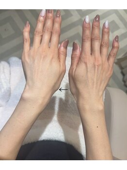 アーティネイルズ(Aaty Nails)/爪だけ綺麗でも意味がない