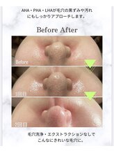 プラスベル(plus Belle)/ラミネーションピール