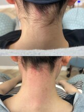 レアー(RHEIA)/うなじWAX