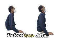 ひでしま整骨院 野芥院/Before After