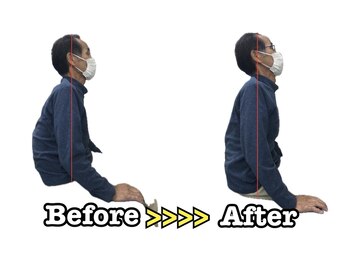 ひでしま整骨院 野芥院/Before After